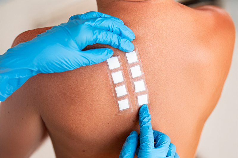 Dermatological Safety Studies