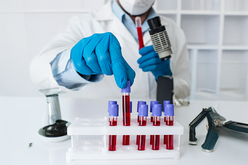 Hemocompatibility Testing (ISO 10993-4)